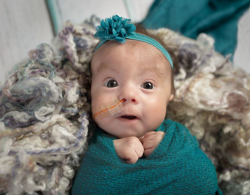 A baby with a feeding tube looks up from a soft blanket.